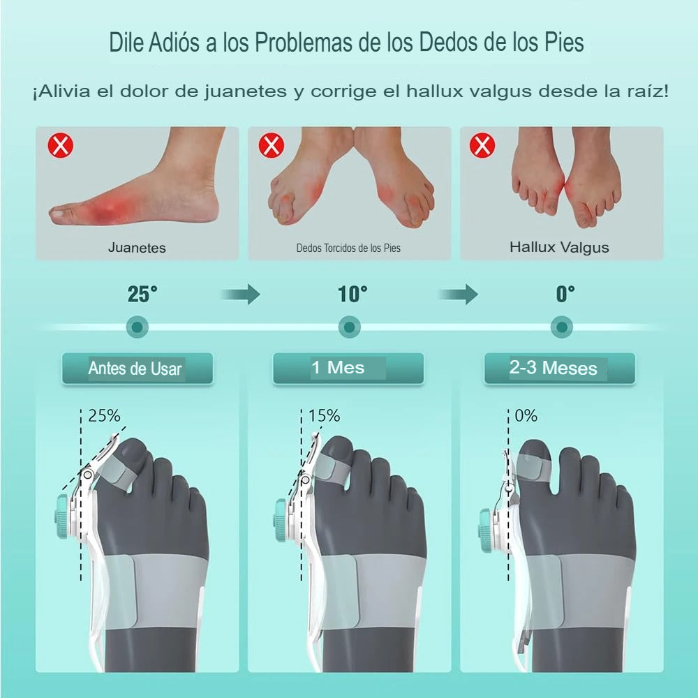Corrector de Juanete